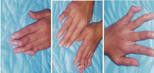 ֣ʪҽԺܣʲôʪԹؽ?