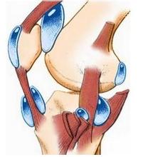 滑膜炎积水怎样热敷 滑膜炎积水怎样热敷