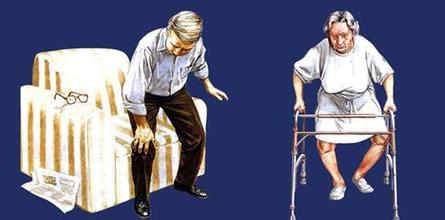 风湿病常见的5类症状 风湿病常见的5类症状