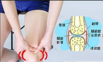 如何做才可避免滑膜炎的出现 如何做才可避免滑膜炎的出现