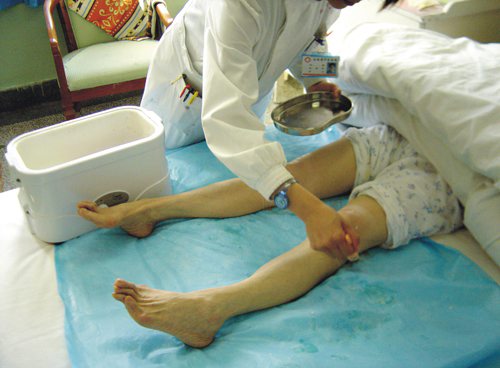 风湿性关节炎的治疗有什么好方法 风湿性关节炎的治疗有什么好方法