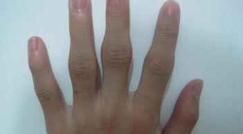 ʪҽԺרҽеʪʲôԭµ