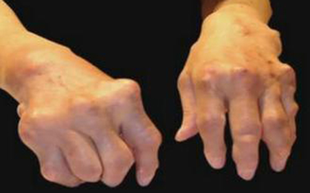 ʪЩ֢״ص㣬ʲôõԤ