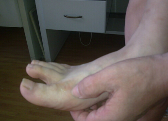 ڵʹѾǺܳˣôʹ֮Щ֢״أ