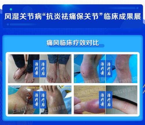 8.19רҴ͹߷ʪؽڲʹؽڡɹƹ