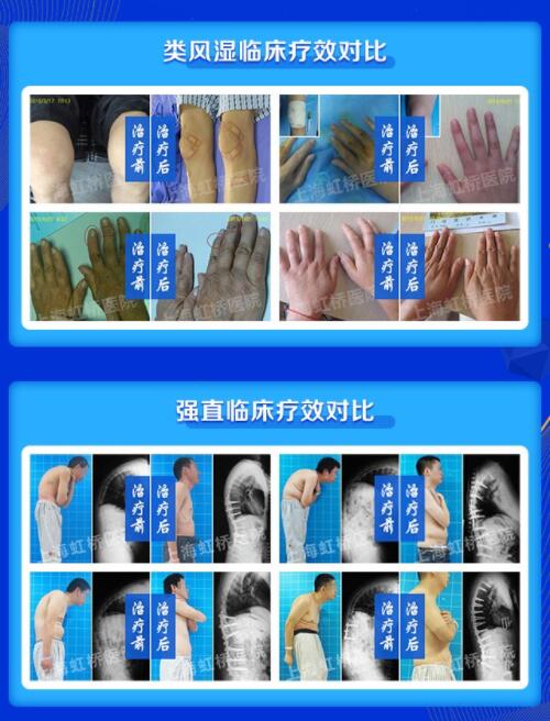 8.19רҴ͹߷ʪؽڲʹؽڡɹƹ