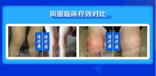 8.19רҴ͹߷ʪؽڲʹؽڡɹƹ